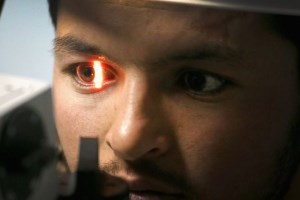 Искусственный интеллект моментально определит риск инфаркта